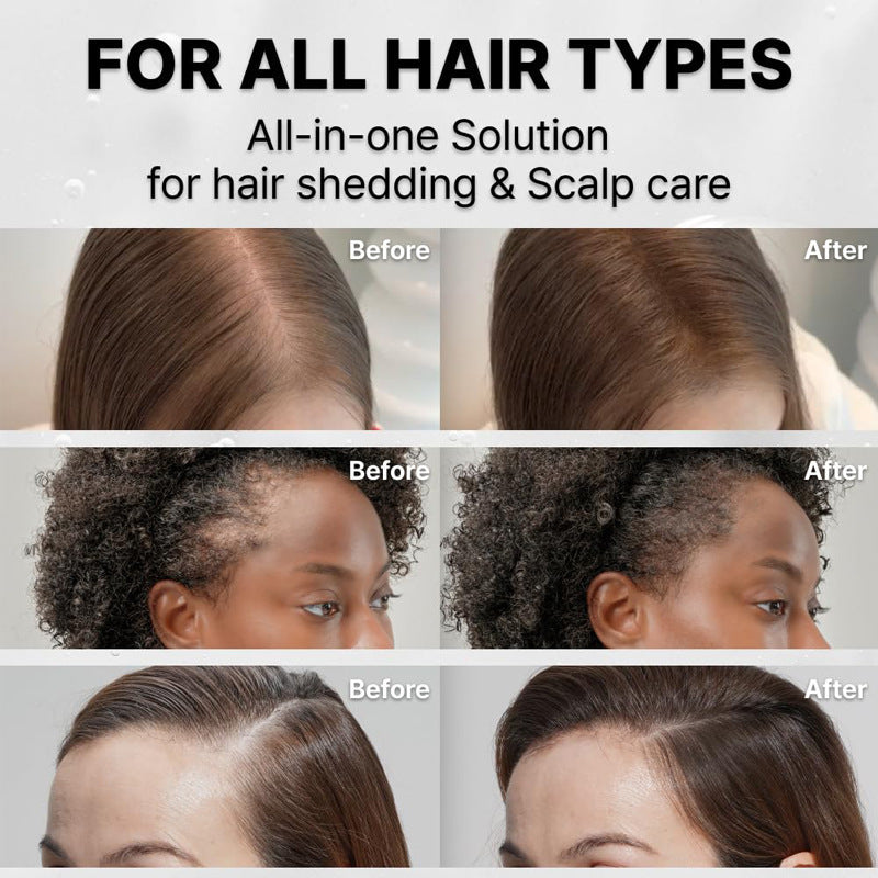 Hair Growth Serum with Built-In Brush Head for Massaging Hair and Improving Scalp